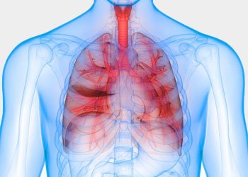 Bronchial Artery Embolization