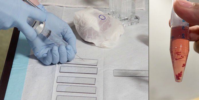 Making FNAC slides and liquid based cytology