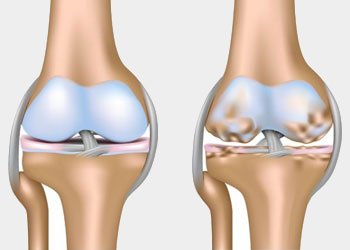 Musculoskeletal (MSK) and Sports Medicine