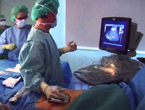 Radiofrequency ablation (RFA) and microwave ablation (MWA)