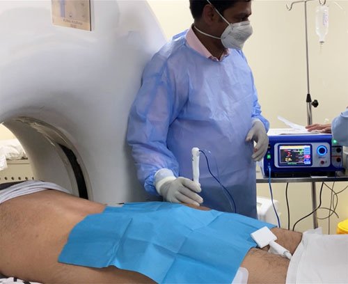 RFA (radio-frequency ablation) Of Osteoid Osteoma